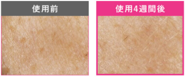 肌の水分量比較